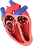 Atrial Fibrillation
