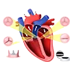 Interventional Cardiology
